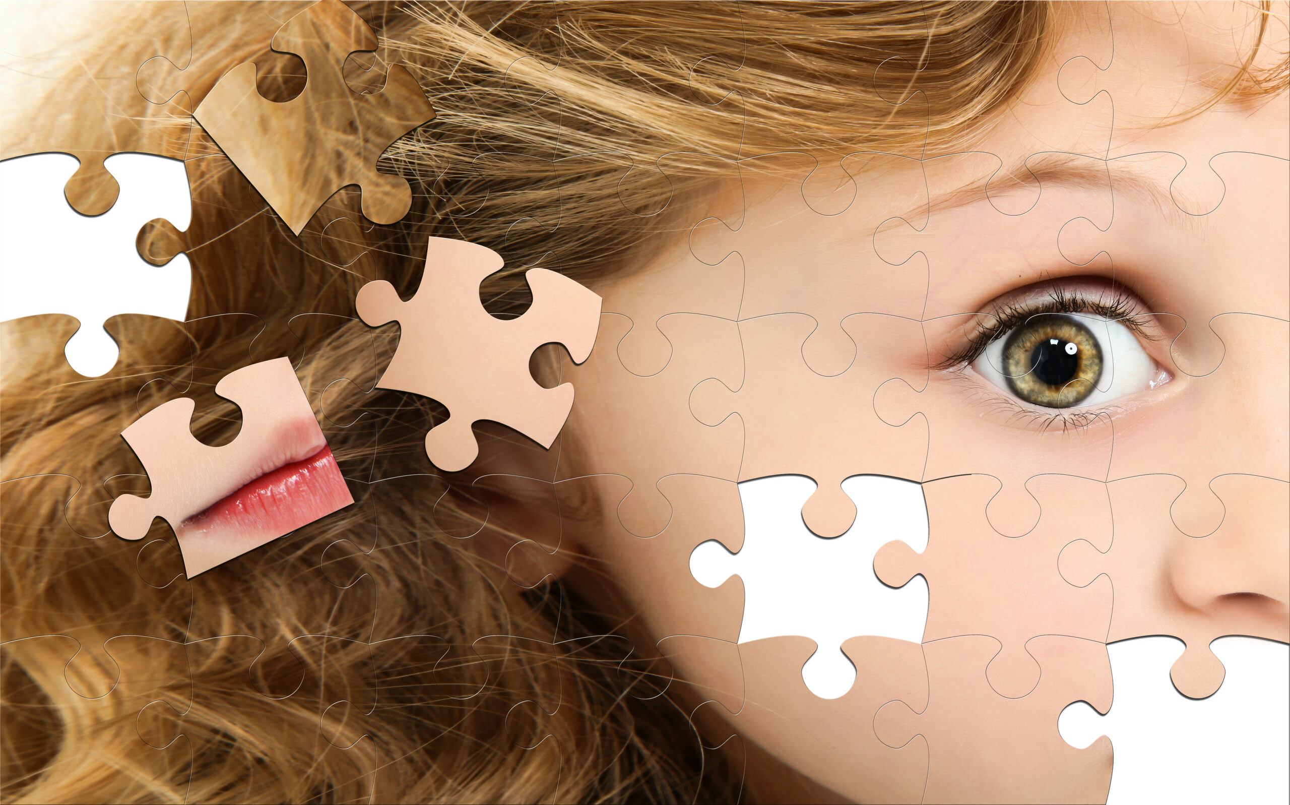 Pediatric Special Needs Include Autism